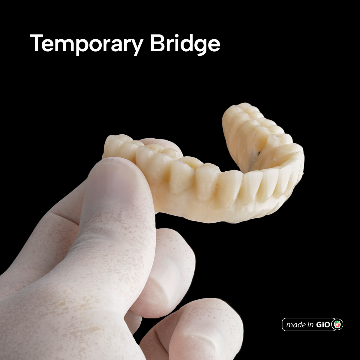 gio-ceramic-crown-bridge