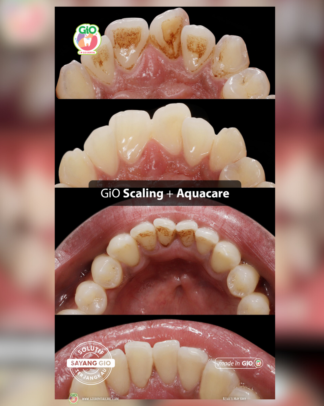 scaling-gigi